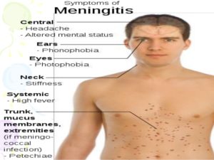 meningitis-ppt-16-638